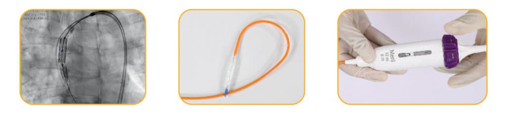 Delivering TAVI tool